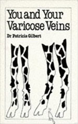 You and Your Varicose Veins (Overcoming common problems)