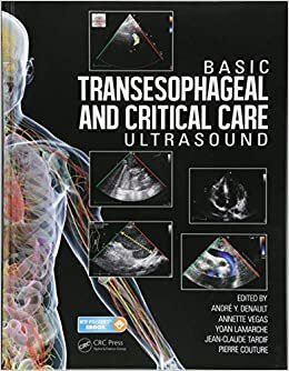 Basic Transesophageal and Critical Care Ultrasound indir