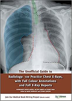 The Unofficial Guide to Radiology: 100 Practice Chest X Rays with Full Colour Annotations and Full X Ray Reports (Unofficial Guides to Medicine)