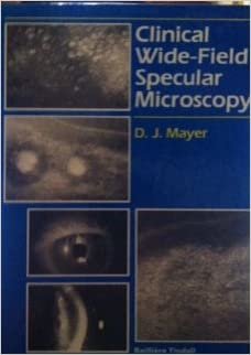 Clinical Wide-field Specular Microscopy