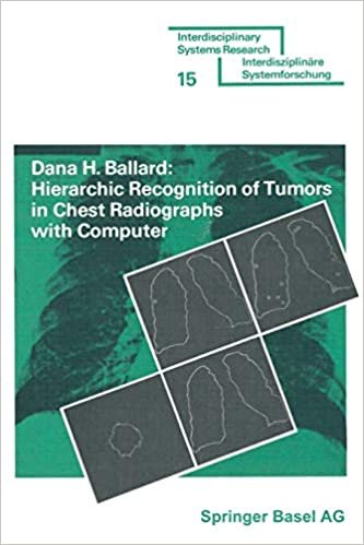 Hierarchic Recognition of Tumors in Chest Radiographs with Computer (ISR, Interdisciplinary Systems Research) indir
