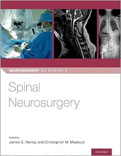 Harrop, J: Spinal Neurosurgery (Neurosurgery by Example, Band 3)