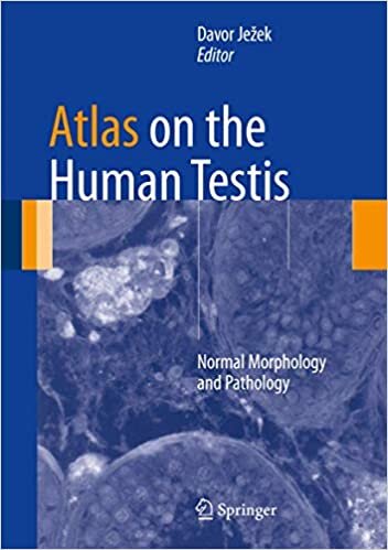 Atlas on the Human Testis: Normal Morphology and Pathology