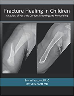 Fracture Healing in Children: A Review of Pediatric Osseous Modeling and Remodeling
