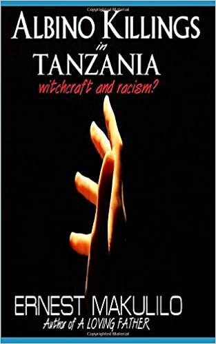 ALBINO KILLINGS IN TANZANIA: Witchcraft and Racism? indir