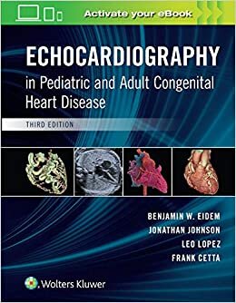 Pediatrik ve Erişkin Konjenital Kalp Hastalığı Ekokardiyografi