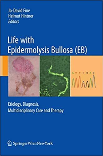 Life with Epidermolysis Bullosa (EB): Etiology, Diagnosis, Multidisciplinary Care and Therapy
