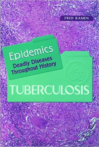 Tuberculosis (Epidemics)