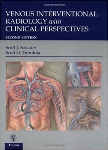 Venous Interventional Radiology With Clinical Perspectives indir