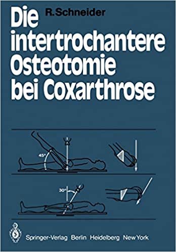 Die Intertrochantere Osteotomie bei Coxarthrose