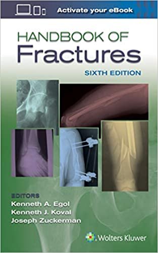 Handbook of Fractures - Sixth Edition