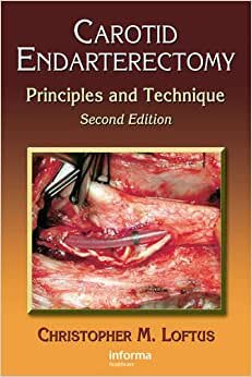 Carotid Endarterectomy: Principals & Techniques: Principles and Technique