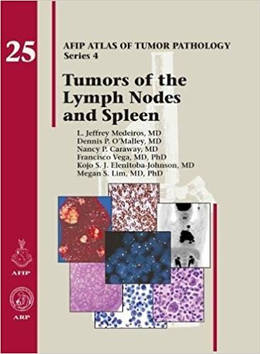 Medeiros, L: Tumors of the Lymph Nodes and Spleen (AFIP Atlas of Tumor Pathology, Series 4,)