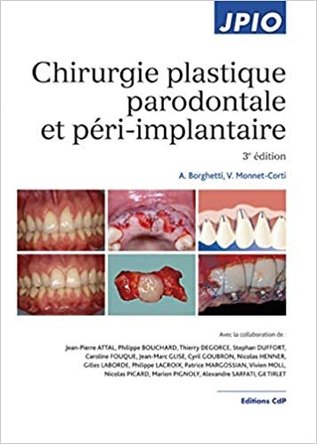 Chirurgie Plastique Parodontale Et Péri-implantaire (JPIO)