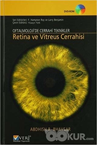 Retina ve Vitreus Cerrahisi: Oftalmoloji'de Cerrahi Teknikler