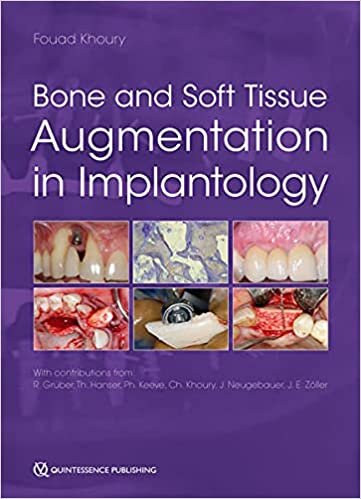 Bone and Soft Tissue Augmentation in Implantology indir