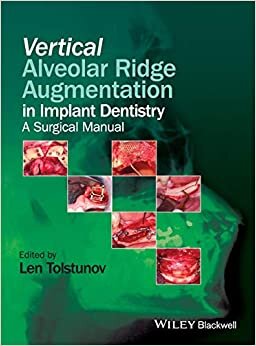 Vertical Alveolar Ridge Augmentation in Implant Dentistry: A Surgical Manual
