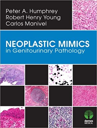 Neoplastic Mimics in Genitourinary Pathology (Pathology of Neoplastic Mimics)