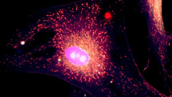 Michael_Cangkrama_Best_Mitochondria_Image-v1