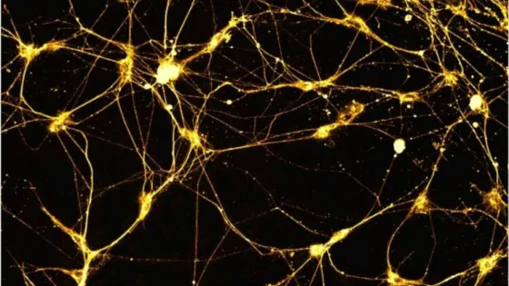 1618528283_53-phonoteka_org-p-neiroset-fon-59-750x469