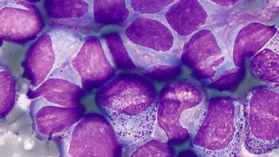 637b539b8dc71_cover_main_gif