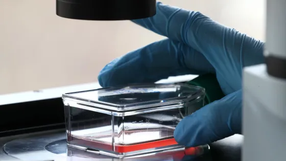 1770550374854881_V_Z2WJqT