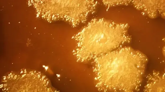 ГМО-бактерии уничтожают солидные опухоли изнутри