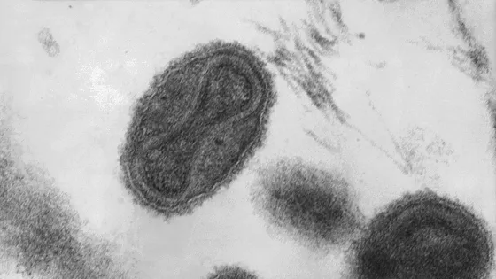 Smallpox_virus_virions_TEM_PHIL_1849-v1