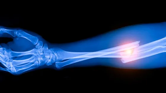 aspdcqv8dpq9odutomgktpwr5qy-v1