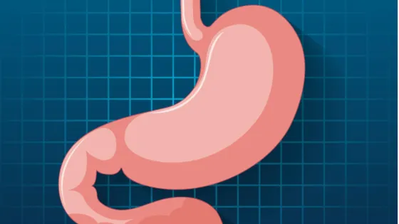 Одобрен новый препарат для лечения рака желудка на ранней стадии