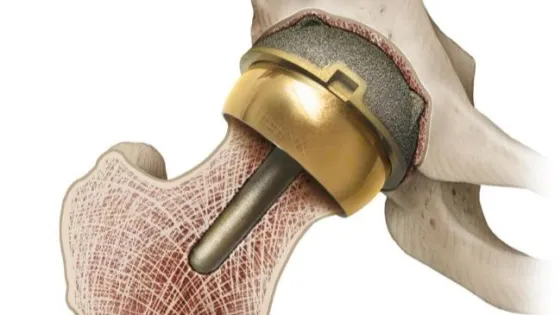 a2d5c7b1a2ad650a92dc3273be292982-v1