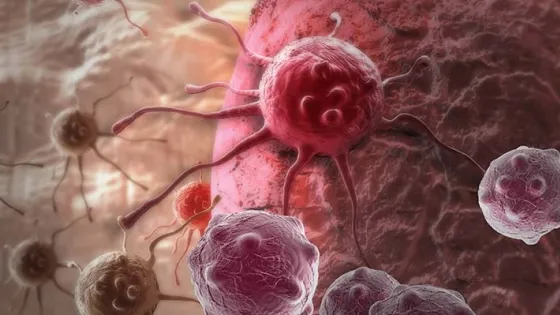 Kak-rakovie-kletki-obrazuyut-opuhol-2-v1