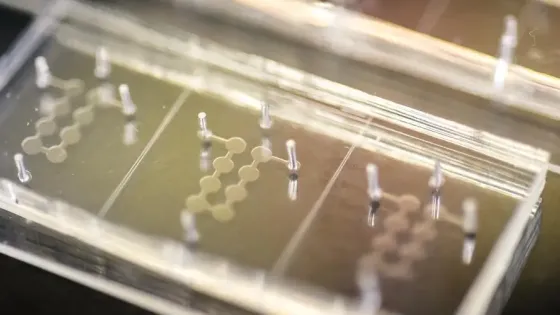 Орган на чипе воспроизводит десятилетия старения человека всего за четыре дня