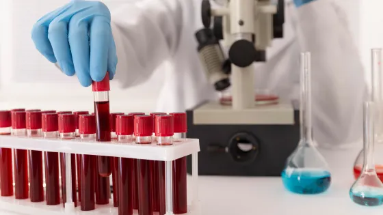 Анализ крови выявляет болезнь Альцгеймера за годы до симптомов