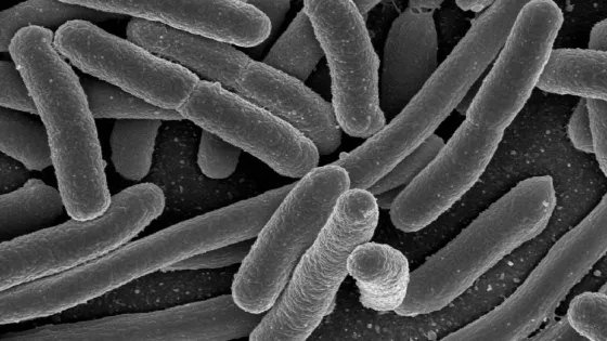 1920px-E._coli_Bacteria_-7316101966--v1