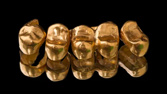 gold-dental-crowns