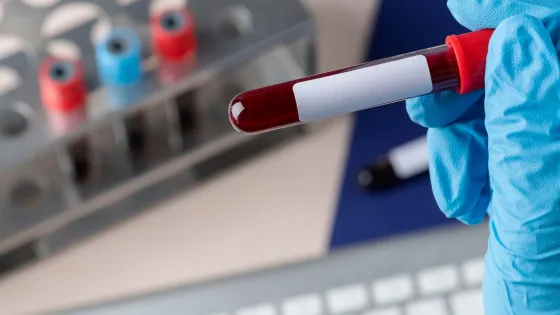 surgeon-holding-blood-test_53876-94763