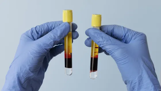 ruki-v-percatkah-derzat-flakony-dla-prp