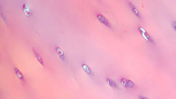 Cartilage_polarised-1