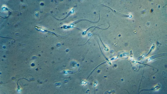 01-human-sperm-GettyImages-170914429