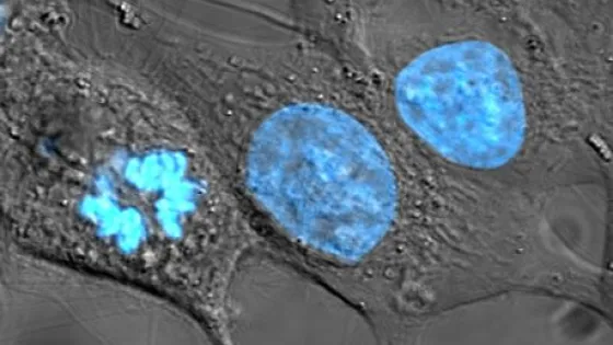 HeLa_cells_stained_with_Hoechst_33258