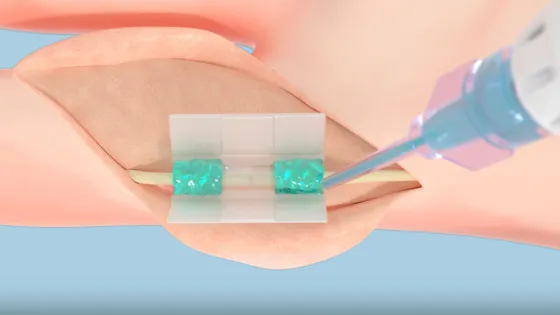 MIT_Tissium-01-press_0