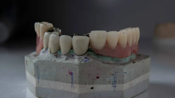 Ozkan-Guner-on-Unsplash-scaled