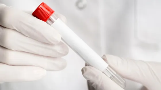 01K4X6M1NYZTYD70NB1FTWP85Y-v1