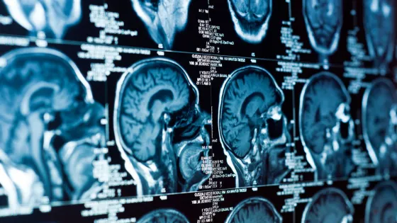 Depositphotos_5683208_xl-2015-pic_32ratio_900x600-900x600-2313