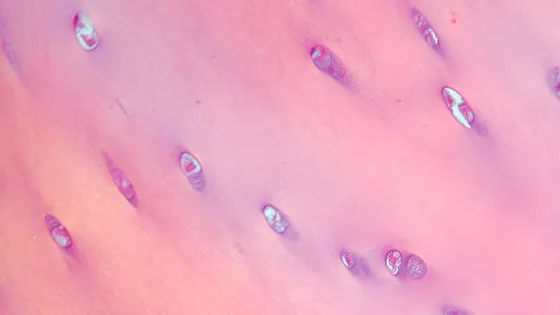 Cartilage_polarised-Picsart-AiImageEnhancer