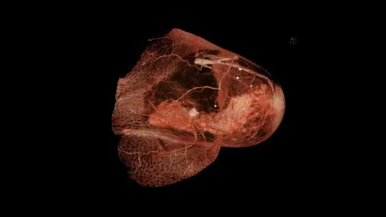 5213479291461505215-1