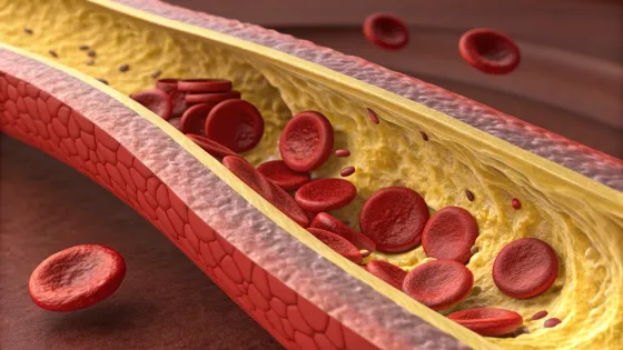 cholesterol-vessels-in-section-under-a-microscope