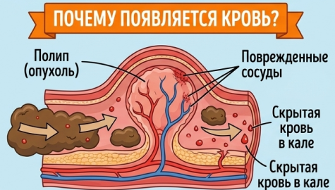 Иммунохроматография hHb