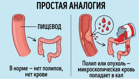 РАПИД-Скрытая кровь-ИХА